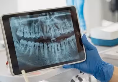 Dental procedure being performed with precision